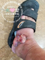 Picture of (CAMPAIGN CLOSED) BENEFICIARY PROFILE 598 LIEW KOON ENG