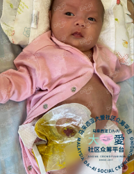 Picture of (CAMPAIGN CLOSED) BENEFICIARY PROFILE 735 CHONG CI EN