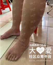 Picture of (CAMPAIGN CLOSED) BENEFICIARY PROFILE 777 TAN PHUI GUAN