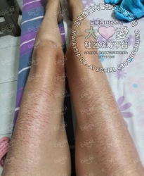 Picture of (CAMPAIGN CLOSED) BENEFICIARY PROFILE 940 CHRISTINE SUSILAWATY EDDY