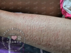 Picture of (CAMPAIGN CLOSED) BENEFICIARY PROFILE 940 CHRISTINE SUSILAWATY EDDY