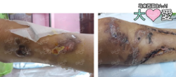 Picture of BENEFICIARY PROFILE 971 LAU YEN CHEN