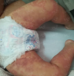 Picture of (CAMPAIGN CLOSED) BENEFICIARY PROFILE 972 HOH KAA CHUN