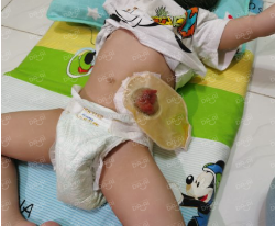 Picture of (CAMPAIGN CLOSED) BENEFICIARY PROFILE 1120 LEW CHENG XIN