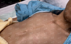 Picture of (CAMPAIGN CLOSED) BENEFICIARY PROFILE 1672 KOH HOCK ANN