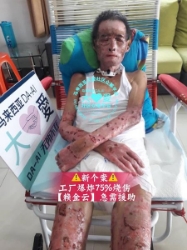 Picture of BENEFICIARY PROFILE 540 LAI JIN YUN
