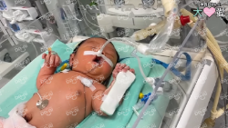 Picture of (CAMPAIGN CLOSED) BENEFICIARY PROFILE 1723 THANG THAWN PAU