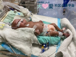 Picture of (CAMPAIGN CLOSED) BENEFICIARY PROFILE 1750 MUHAMMAD SETH FAYYADH