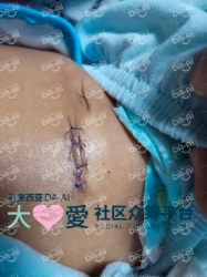 Picture of (CAMPAIGN CLOSED) BENEFICIARY PROFILE 1753 SOFIYATUS SHOLIHAH BINTI DEMAIRI