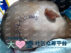 Picture of (CAMPAIGN CLOSED) BENEFICIARY PROFILE 1753 SOFIYATUS SHOLIHAH BINTI DEMAIRI