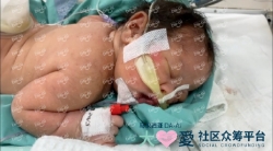 Picture of BENEFICIARY PROFILE 1767 BABY OF MARIANI NURDINSYAM