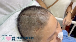 Picture of (CAMPAIGN CLOSED) BENEFICIARY PROFILE 1823 CORNY WONG YANG SHIAK