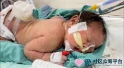 Picture of BENEFICIARY PROFILE 1767 BABY OF MARIANI NURDINSYAM