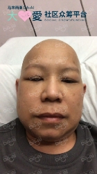Picture of BENEFICIARY PROFILE 1832 CHEW HUI YEW