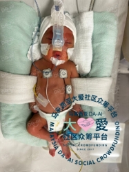 Picture of (CAMPAIGN CLOSED) BENEFICIARY PROFILE 1846 BABY WONG SANG WAH