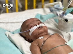 Picture of (CAMPAIGN CLOSED) BENEFICIARY PROFILE 1915 IMAAN HUSSAIN NABI HUSSAIN