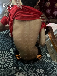 Picture of (CAMPAIGN CLOSED) BENEFICIARY PROFILE 2026 KUGAN A/L THENNARASU