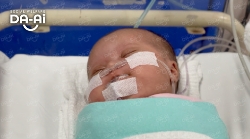 Picture of (CAMPAIGN CLOSED) BENEFICIARY PROFILE2040 BABY OF WAHYU PUTRI NINGSIH