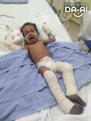 Picture of (CAMPAIGN CLOSED) BENEFICIARY PROFILE 2082 MOHAMAD ZIYAD AMZAR BIN MOHAMAD RAZIF