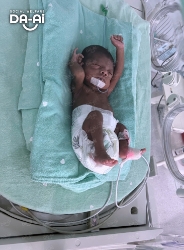 Picture of FUNDRAISING CASE 2093 BABY NURIYAH