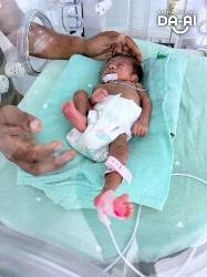 Picture of FUNDRAISING CASE 2093 BABY NURIYAH