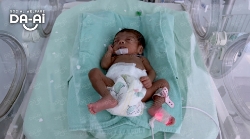 Picture of FUNDRAISING CASE 2093 BABY NURIYAH