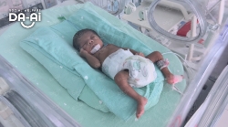 Picture of FUNDRAISING CASE 2093 BABY NURIYAH