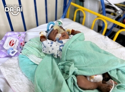 Picture of FUNDRAISING CASE 2123 MUHAMAD ARMAN MUHAMAD SALIM
