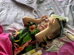 Picture of (CAMPAIGN CLOSED) BENEFICIARY PROFILE 2142 PUTERI CHARISSA BINTI ADDIE WIJAYA