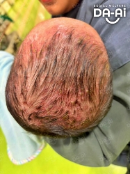 Picture of (CAMPAIGN CLOSED) BENEFICIARY PROFILE 2156 MUHAMMAD NAIM PAHLEVI ANAS