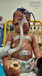 Picture of FUNDRAISING CASE 2156 MUHAMMAD NAIM PAHLEVI ANAS