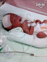 Picture of FUNDRAISING CASE 2173 ADELYNN YIP JIA XUAN