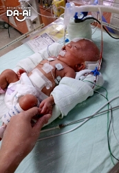 Picture of (CAMPAIGN CLOSED) BENEFICIARY PROFILE 2173 ADELYNN YIP JIA XUAN