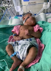 Picture of FUNDRAISING CASE 2182 POYAKSHAN RAU A/L MOHANRAU