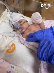 Picture of FUNDRAISING CASE 2188 NUR AURA SYAFIA BINTI MUHAMMAD SHAHRUL ARIF