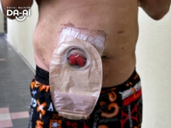 Picture of FUNDRAISING CASE 2210 CHOI YEW LOY