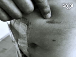 Picture of FUNDRAISING CASE 2210 CHOI YEW LOY