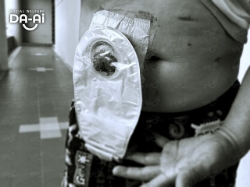 Picture of FUNDRAISING CASE 2210 CHOI YEW LOY