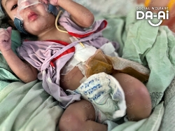 Picture of FUNDRAISING CASE 2236 NUR SYIFA AULIYA BINTI KHAIRUL AZMEER