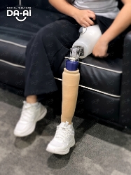 Picture of FUNDRAISING CASE 2242 ABBY NABILA SATEVE