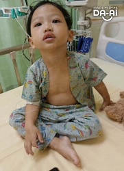 Picture of FUNDRAISING CASE 2294  MUHAMMAD HAFIZ BIN ABDULLAH